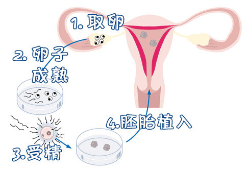 国内那里有借卵代孕